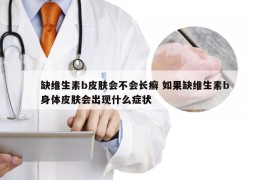 缺维生素b皮肤会不会长癣 如果缺维生素b身体皮肤会出现什么症状