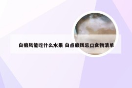 白癜风能吃什么水果 白点癫风忌口食物清单