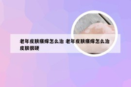 老年皮肤瘙痒怎么治 老年皮肤瘙痒怎么治 皮肤很硬