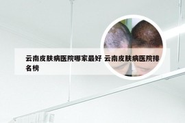 云南皮肤病医院哪家最好 云南皮肤病医院排名榜