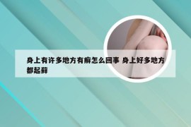身上有许多地方有癣怎么回事 身上好多地方都起藓