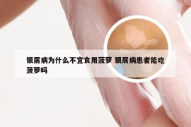 银屑病为什么不宜食用菠萝 银屑病患者能吃菠萝吗