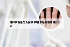 脚脖长癣是怎么回事 脚脖子起癣很痒用什么药