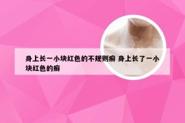身上长一小块红色的不规则癣 身上长了一小块红色的癣