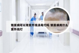银屑病可以用紫外线消毒灯吗 银屑病用什么紫外线灯