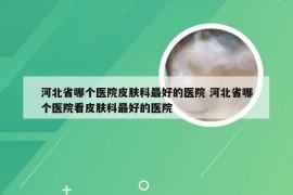 河北省哪个医院皮肤科最好的医院 河北省哪个医院看皮肤科最好的医院