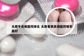 太原牛皮癣医院排名 太原看银屑病医院哪家最好