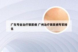 广东专业治疗银屑病 广州治疗银屑病专家排名