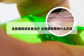 皮肤骚痒症患者治疗 皮肤骚扰痒用什么药膏