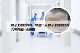 脖子上皮肤白白一块是什么 脖子上的皮肤有几块白是什么原因