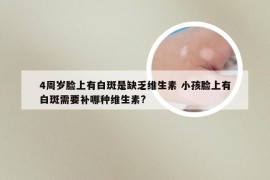 4周岁脸上有白斑是缺乏维生素 小孩脸上有白斑需要补哪种维生素?