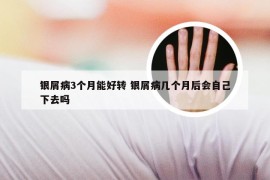 银屑病3个月能好转 银屑病几个月后会自己下去吗