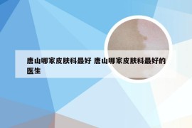 唐山哪家皮肤科最好 唐山哪家皮肤科最好的医生