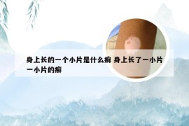 身上长的一个小片是什么癣 身上长了一小片一小片的癣