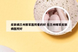 皮肤病兰州那家医院看的好 在兰州哪家皮肤病医院好