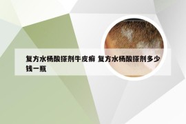 复方水杨酸搽剂牛皮癣 复方水杨酸搽剂多少钱一瓶