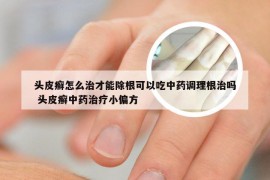头皮癣怎么治才能除根可以吃中药调理根治吗 头皮癣中药治疗小偏方