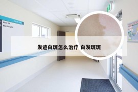 发迹白斑怎么治疗 白发斑斑