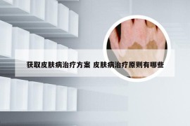 获取皮肤病治疗方案 皮肤病治疗原则有哪些