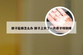 膀子起癣怎么办 膀子上长了一片疹子特别痒