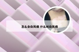 怎么会白风病 什么叫白风病