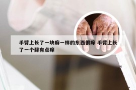 手臂上长了一块癣一样的东西很痒 手臂上长了一个藓有点痒