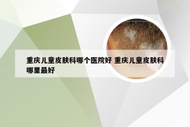 重庆儿童皮肤科哪个医院好 重庆儿童皮肤科哪里最好