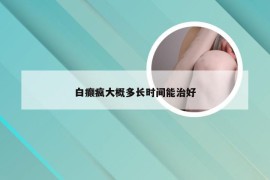 白癫疯大概多长时间能治好