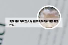 出生时有白斑怎么办 孩子出生有白斑需要治疗吗