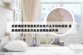 皮肤病经常用激素药会有什么不好的症状 皮肤病使用激素药后会有哪些副作用