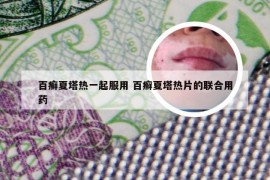 百癣夏塔热一起服用 百癣夏塔热片的联合用药