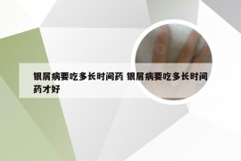 银屑病要吃多长时间药 银屑病要吃多长时间药才好