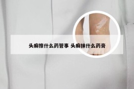 头癣擦什么药管事 头癣抹什么药膏