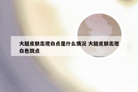 大腿皮肤出现白点是什么情况 大腿皮肤出现白色斑点