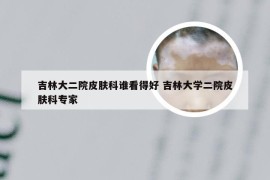 吉林大二院皮肤科谁看得好 吉林大学二院皮肤科专家