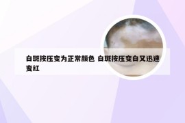白斑按压变为正常颜色 白斑按压变白又迅速变红
