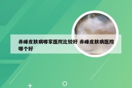 赤峰皮肤病哪家医院比较好 赤峰皮肤病医院哪个好