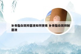 补骨脂白斑抑菌液如何使用 补骨脂白斑抑制菌液