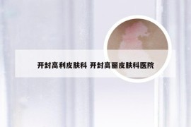 开封高利皮肤科 开封高丽皮肤科医院