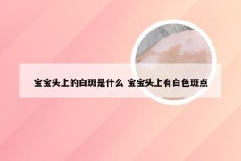 宝宝头上的白斑是什么 宝宝头上有白色斑点