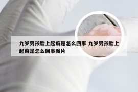 九岁男孩脸上起癣是怎么回事 九岁男孩脸上起癣是怎么回事图片