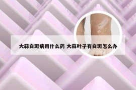 大蒜白斑病用什么药 大蒜叶子有白斑怎么办