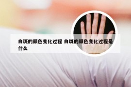 白斑的颜色变化过程 白斑的颜色变化过程是什么