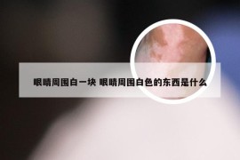 眼睛周围白一块 眼睛周围白色的东西是什么