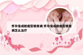 怀孕变成脓疱型银屑病 怀孕变成脓疱型银屑病怎么治疗