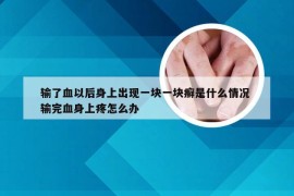 输了血以后身上出现一块一块癣是什么情况 输完血身上疼怎么办