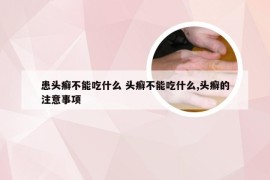 患头癣不能吃什么 头癣不能吃什么,头癣的注意事项