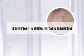 提供三门峡牛皮癣医院 三门峡皮肤科哪家好
