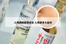 人得病癣尾期症状 人得癣多久能好