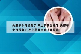 头癣半个月没有了,不上药又出来了 头癣半个月没有了,不上药又出来了正常吗